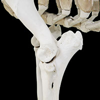 肘関節の写真（2-3）サムネイル