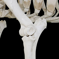 肘関節の写真（3-3）サムネイル