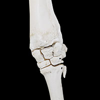 手根関節の写真（3−3）サムネイル