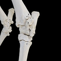 足根関節の写真（1−3）サムネイル