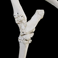 足根関節の写真（3−3）サムネイル