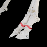 近位趾節間関節の写真（1-3）サムネイル