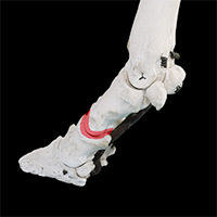 近位趾節間関節の写真（3-3）サムネイル