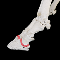 遠位趾節間関節の写真（2-3）サムネイル