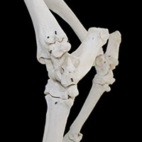 足根骨の写真