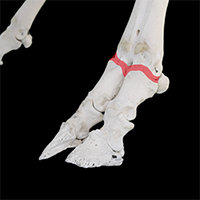 中足趾節関節の写真（1-3）サムネイル