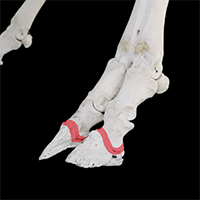 遠位趾節間関節の写真（1-3）サムネイル