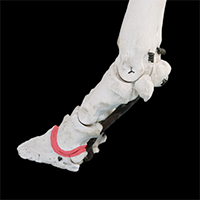遠位趾節間関節の写真（3-3）サムネイル